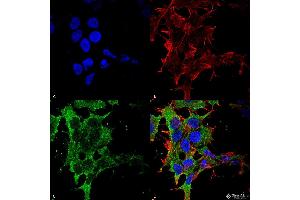Immunocytochemistry/Immunofluorescence analysis using Mouse Anti-GABA-B Receptor 2 Monoclonal Antibody, Clone S81-2 . (GABBR2 antibody  (AA 861-912))
