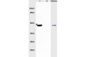 Lane 1: mouse brain lysates Lane 2: human colon carcinoma lysates probed with Anti MMP-23 Polyclonal Antibody, Unconjugated (ABIN759176) at 1:200 in 4 °C.