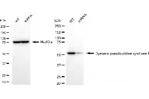 Western blotting analysis using dyskerin pseudouridine synthase 1 antibody (ABIN7798408). (Recombinant DKC1 antibody)