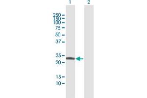 Western Blot analysis of COMT expression in transfected 293T cell line by COMT MaxPab polyclonal antibody. (COMT antibody  (AA 1-221))