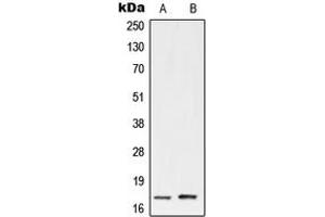 Western blot analysis of UBE2A/B expression in HeLa (A), Jurkat (B) whole cell lysates. (UBE2A/B (C-Term) antibody)