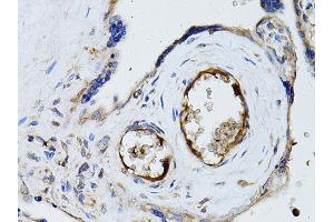 Immunohistochemistry of paraffin-embedded human placenta using RYR2 Antibody (ABIN5970123) at dilution of 1/100 (40x lens). (RYR2 antibody)