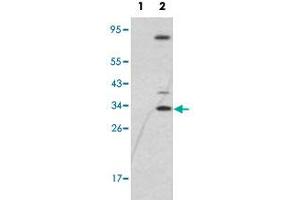 Western blot analysis of SNAI1 (arrow) using SNAI1 polyclonal antibody . (SNAIL antibody  (N-Term))