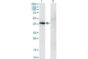 Western Blot analysis of NOV expression in transfected 293T cell line by NOV monoclonal antibody (M02), clone 2G8. (NOV antibody  (AA 32-131))
