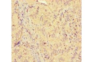 Immunohistochemistry of paraffin-embedded human adrenal gland tissue using ABIN7158468 at dilution of 1:100 (ICE1 (AA 1213-1505) antibody)