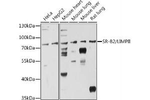 Western blot analysis of extracts of various cell lines, using SR-B2/LIMPII antibody (ABIN6127596, ABIN6147412, ABIN6147414 and ABIN6216462) at 1:3000 dilution. (SCARB2 antibody  (AA 200-380))