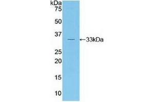 Western Blotting (WB) image for anti-RAR-Related Orphan Receptor C (RORC) (AA 212-461) antibody (ABIN7439402)