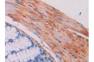 Detection of MYLK in Mouse Colon Tissue using Polyclonal Antibody to Myosin Light Chain Kinase (MYLK)