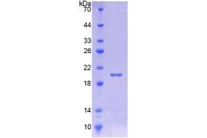SDS-PAGE (SDS) image for Calmodulin-Like 5 (CALML5) (AA 1-146) protein (His tag) (ABIN4990484) (CALML5 Protein (AA 1-146) (His tag))