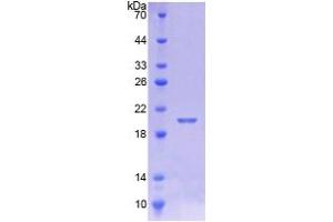 SDS-PAGE (SDS) image for Calmodulin-Like 5 (CALML5) (AA 1-146) protein (His tag) (ABIN6237135)