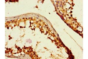 Immunohistochemistry of paraffin-embedded human testis tissue using ABIN7146159 at dilution of 1:100 (C2CD3 antibody  (AA 2079-2265))