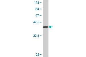 Western Blot detection against Immunogen (37. (TBCB antibody  (AA 31-130))