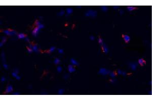 Frozen equine sacroid tissue section was stained with anti-CD8 followed by Goat Anti-Mouse IgG3, Human ads-TRITC (Goat anti-Mouse IgG3 (Heavy Chain) Antibody (TRITC))