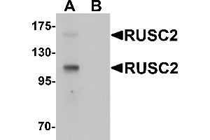 Western blot analysis of RUSC2 in SK-N-SH cell lysate with RUSC2 antibody at 1 µg/mL in (A) the absence and (B) the presence of blocking peptide