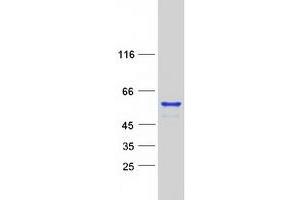 Western Blotting (WB) image for Meis Homeobox 2 (MEIS2) (Transcript Variant F) protein (Myc-DYKDDDDK Tag) (ABIN2725784)