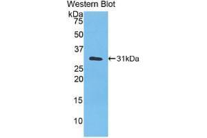 Western blot analysis of recombinant Human CA3. (CA3 antibody  (AA 2-260))