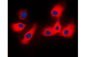 Immunofluorescent analysis of 14-3-3 epsilon staining in NIH3T3 cells. (YWHAE antibody  (C-Term))