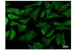 Immunostaining analysis in HeLa cells. (COX4NB antibody)