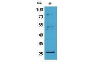 Western Blotting (WB) image for anti-CD81 (CD81) (Internal Region) antibody (ABIN3187900) (CD81 antibody  (Internal Region))