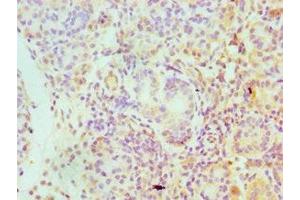 Immunohistochemistry of paraffin-embedded human pancreatic tissue using ABIN7157225 at dilution of 1:100 (SERPINA4 antibody  (AA 178-427))