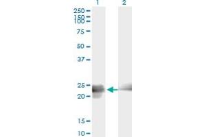 Western Blot analysis of BIN3 expression in transfected 293T cell line by BIN3 monoclonal antibody (M01A), clone 3G3.