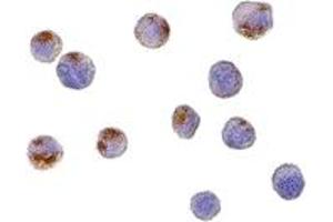 Immunohistochemistry (IHC) image for anti-Complement C1q Tumor Necrosis Factor-Related Protein 6 (C1QTNF6) (C-Term) antibody (ABIN1030348) (CTRP6 antibody  (C-Term))