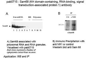 Image no. 1 for anti-KH Domain-Containing, RNA-Binding, Signal Transduction-Associated Protein (Sam68) antibody (ABIN559716) (KH Domain-Containing, RNA-Binding, Signal Transduction-Associated Protein (Sam68) antibody)