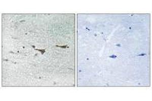 Immunohistochemistry analysis of paraffin-embedded human brain tissue using TOB1 (Ab-164) antiobdy. (Protein Tob1 (TOB1) (Ser164) antibody)