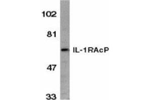 Western blot analysis of IL-1RAcP in HeLa whole cell lysate with AP30411PU-N IL-1RAcP antibody (C2) at 1/1000 dilution. (FBXO43 antibody  (C-Term))