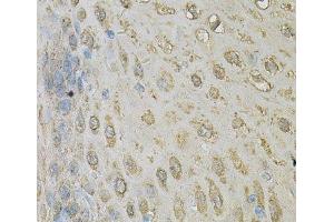 Immunohistochemistry of paraffin-embedded Human esophagus using ALDH3A1 Polyclonal Antibody at dilution of 1:100 (40x lens). (ALDH3A1 antibody)