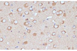 Immunohistochemistry of paraffin-embedded Mouse brain using COPG2 Polyclonal Antibody at dilution of 1:100 (40x lens). (COPG2 antibody)