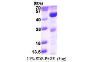 SDS-PAGE (SDS) image for Acyl-CoA Dehydrogenase, Long Chain (ACADL) (AA 31-430) protein (His tag) (ABIN667975) (ACADL Protein (AA 31-430) (His tag))
