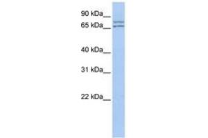 Image no. 1 for anti-DEAD (Asp-Glu-Ala-Asp) Box Polypeptide 27 (DDX27) (AA 35-84) antibody (ABIN6742687) (DDX27 antibody  (AA 35-84))