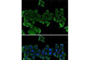 Immunofluorescence analysis of U2OS cells using COMP Polyclonal Antibody