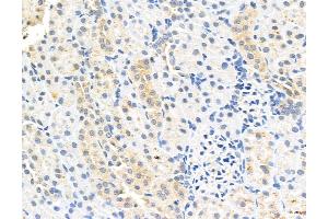 ABIN6260811 and ABIN6272991 at 1/100 staining Rat kidney tissue by IHC-P. (CHMP2A antibody  (Internal Region))