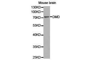 Western Blotting (WB) image for anti-Dystrophin (DMD) antibody (ABIN1872293) (Dystrophin antibody)