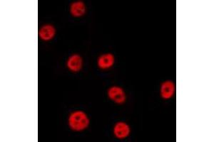 ABIN6274041 staining Hela by IF/ICC. (PTBP2 antibody  (Internal Region))