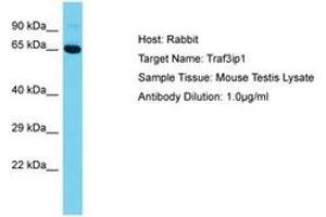 Image no. 1 for anti-TNF Receptor-Associated Factor 3 Interacting Protein 1 (TRAF3IP1) (AA 42-91) antibody (ABIN6750346) (TRAF3IP1 antibody  (AA 42-91))