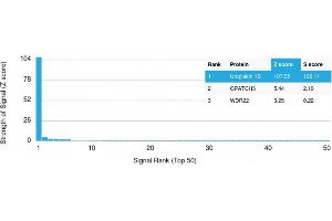 Analysis of Protein Array containing more than 19,000 full-length human proteins using Uroplakin 1B Mouse Monoclonal Antibody (UPK1B/3102) Z- and S- Score: The Z-score represents the strength of a signal that a monoclonal antibody (MAb) (in combination with a fluorescently-tagged anti-IgG secondary antibody) produces when binding to a particular protein on the HuProtTM array. (Uroplakin 1B antibody  (AA 109-229))