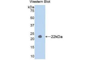 Western Blotting (WB) image for anti-Matrix Metallopeptidase 1 (Interstitial Collagenase) (MMP1) (AA 98-275) antibody (Biotin) (ABIN1172278) (MMP1 antibody  (AA 98-275) (Biotin))