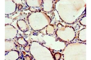 Immunohistochemistry of paraffin-embedded human thyroid tissue using ABIN7152570 at dilution of 1:100