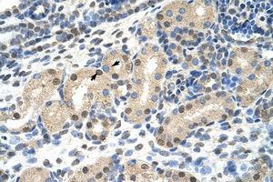 Image no. 1 for anti-MLX Interacting Protein-Like (MLXIPL) (N-Term) antibody (ABIN203213) (MLXIPL antibody  (N-Term))