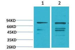 Western Blotting (WB) image for anti-Phosphoinositide 3 Kinase, p85 alpha (PI3K p85a) antibody (ABIN3179081) (PIK3R1 antibody)