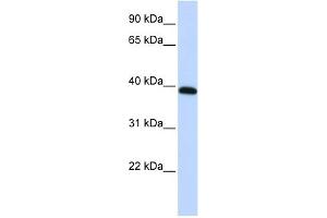 WB Suggested Anti-HOXA10 Antibody Titration:  0. (HOXA10 antibody  (Middle Region))
