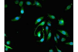 Immunofluorescent analysis of Hela cells using ABIN7163206 at dilution of 1:100 and Alexa Fluor 488-congugated AffiniPure Goat Anti-Rabbit IgG(H+L) (PIGA antibody  (AA 443-484))