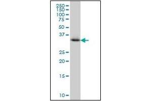 Western Blotting (WB) image for anti-Crystallin, mu (CRYM) (AA 215-315) antibody (ABIN614593) (CRYM antibody  (AA 215-315))