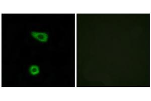 Immunofluorescence analysis of HuvEc cells, using TNAP2 antibody. (TNFAIP2 antibody  (Internal Region))