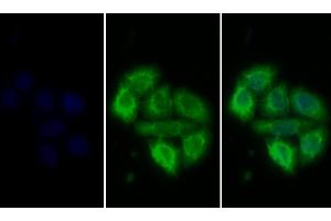 Detection of PRLR in Human MCF7 cell using Polyclonal Antibody to Prolactin Receptor (PRLR) (Prolactin Receptor antibody  (AA 25-234))