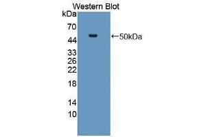 Western blot analysis of the recombinant protein. (HYAL1 antibody  (AA 40-449))