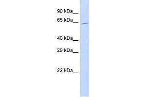 Host:  Rabbit  Target Name:  SLC25A13  Sample Type:  721_B Whole Cell lysates  Antibody Dilution:  1. (slc25a13 antibody  (C-Term))
